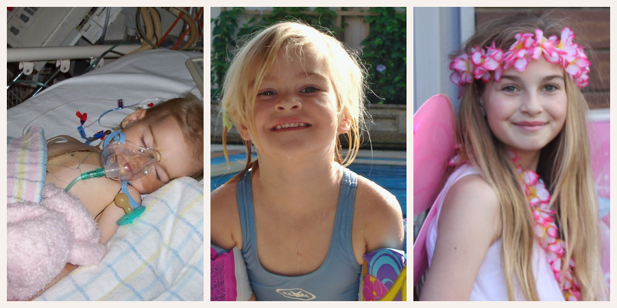 ID: three photos of the same girl. 1. as a baby lying in ICU with a large scar down her chest following open-heart surgery. 2. a smiling three year old in bathers with a faint scar down her chest. 3. the girl as a teenager with fairy wings and smiling at the camera.
